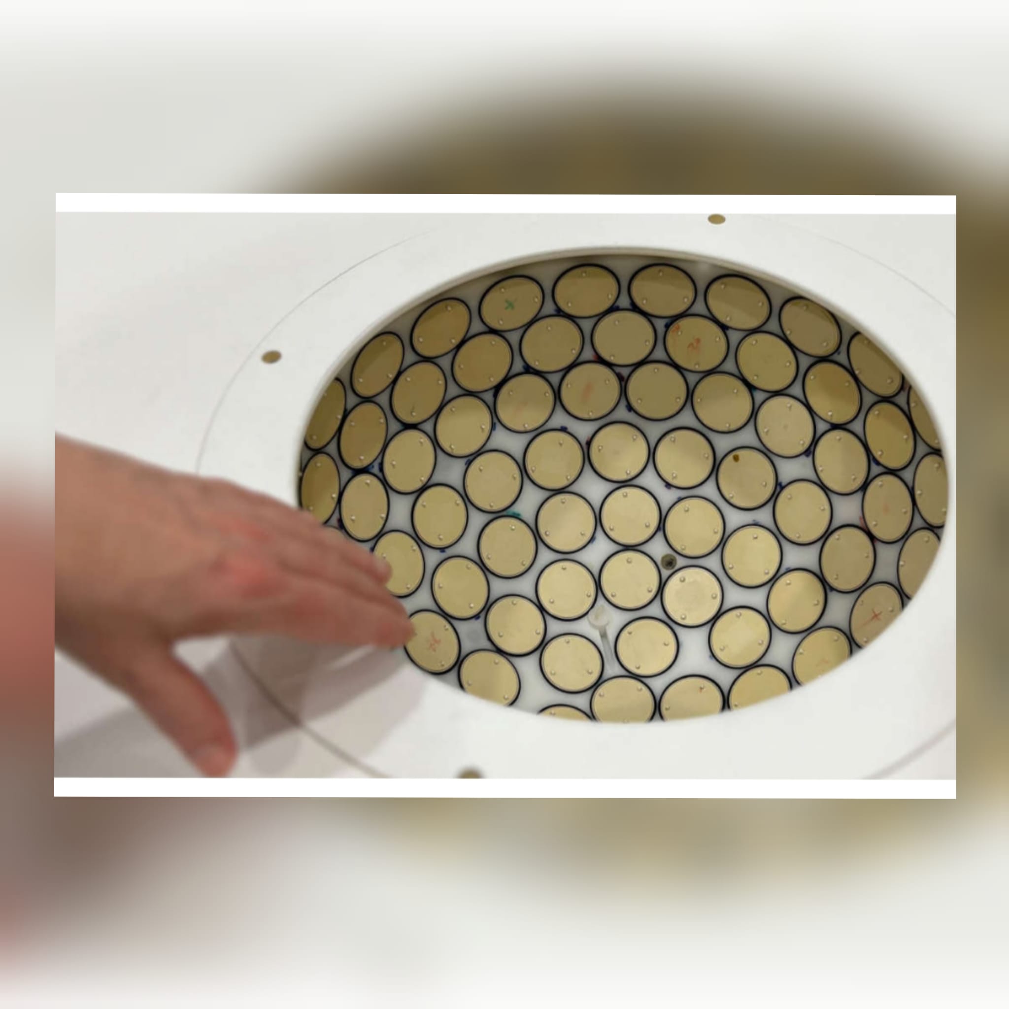 Ultrasonido 3D: Un Avance Prometedor En El Cribado Del Cáncer De Mama